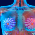 Understanding the Link Between HRT and Breast Cancer